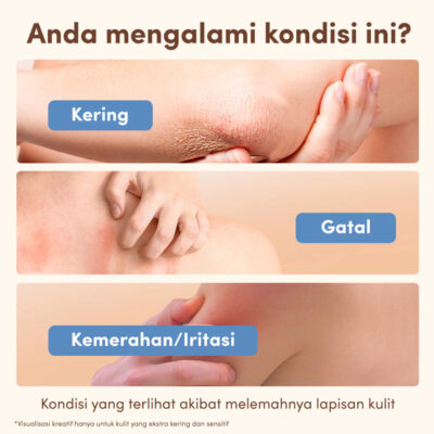 AVEENO Dermexa Daily Emollient Cream 200g-Lotion Pelembap untuk Kulit Sensitif, Kering & Rawan Eksim thumbnail 4