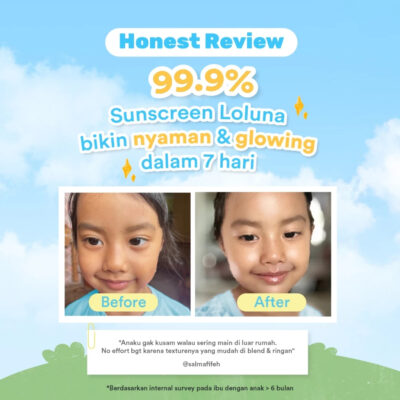 Loluna Baby Face & Body Sunscreen 30ml SPF 50+ PA++++ dengan 5x Ceramide & Niacinamide thumbnail 5