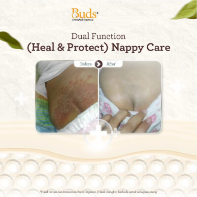 Buds Organics Baby Bum Balm 50ml - Lotion atau Krim Perawatan Ruam Popok Pantat Bayi dan Anak thumbnail 5